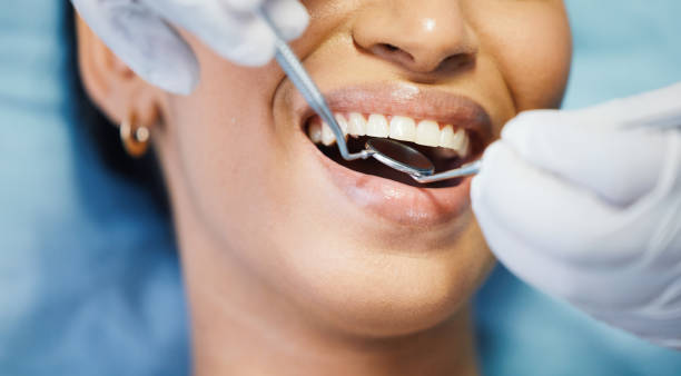 Best Emergency Root Canal Therapy in Midvale, UT